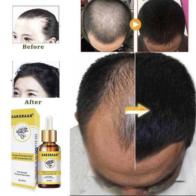 Hair Loss Products Natural With No Side Effects - wellnesshop