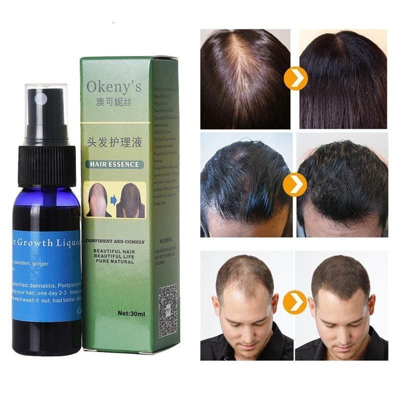 Sunburst Hair Growth Products for women&men anti hair loss products Alopecia Baldness beard oil growth Hair growth spray - wellnesshop